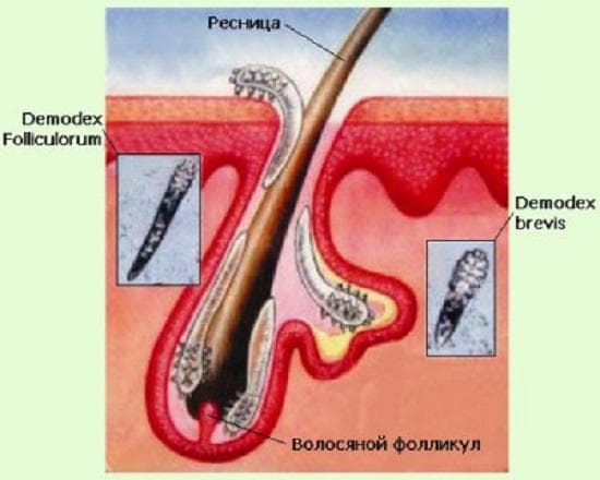 demodex_bolos_gistologja1