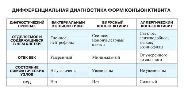 формы конъюнктивита