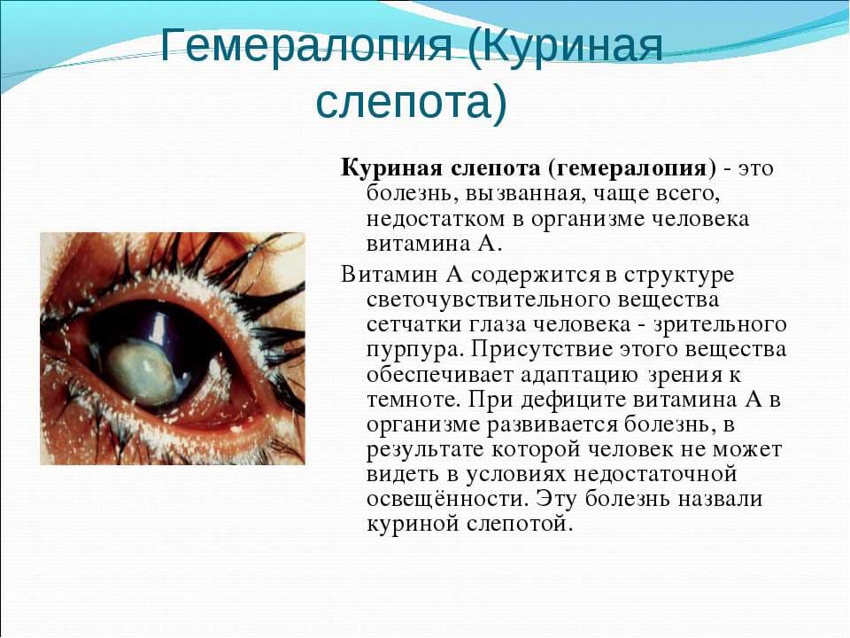 гемералопия