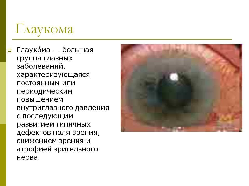 glaukoma
