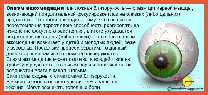 golovnaya-bol-miopiya-41661-large