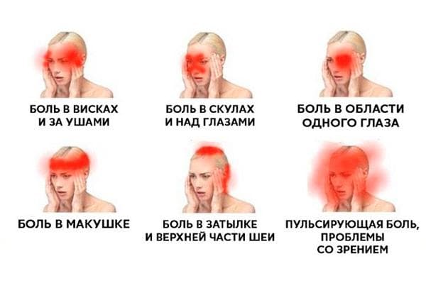 golovnaya-bol-otdaet-v-viski-i-zuby-4903-large