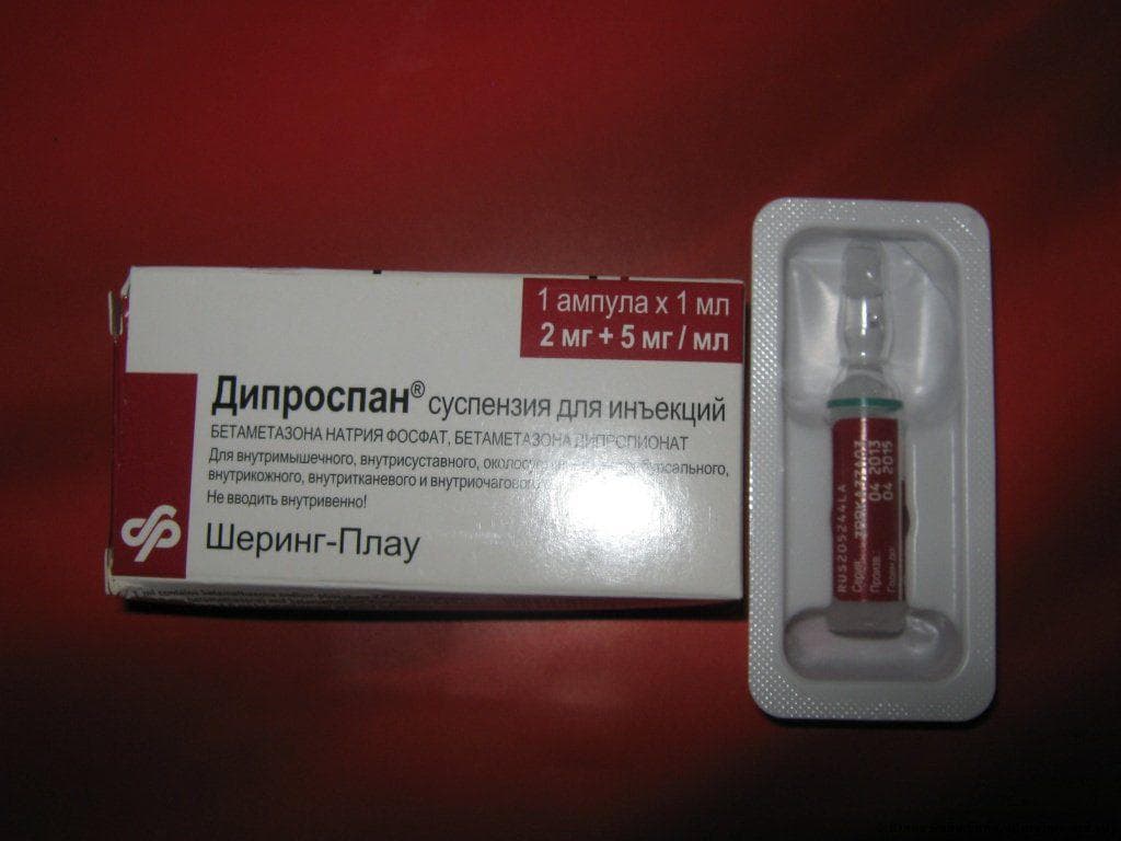 халязион, халязион верхнего века лечение, халязион лечение, халязион фото, халязион нижнего века, халязион верхнего века, халязион у ребенка лечение, халязион у ребенка, халязион нижнего века лечение,