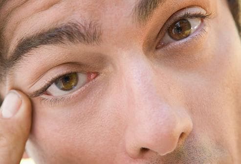 here-is-what-is-causing-your-eyelid-twitch