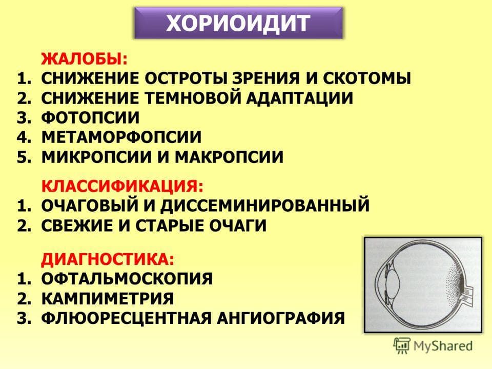 xorioidit