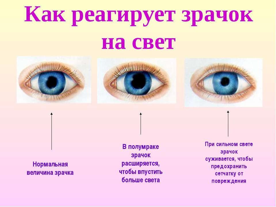 _