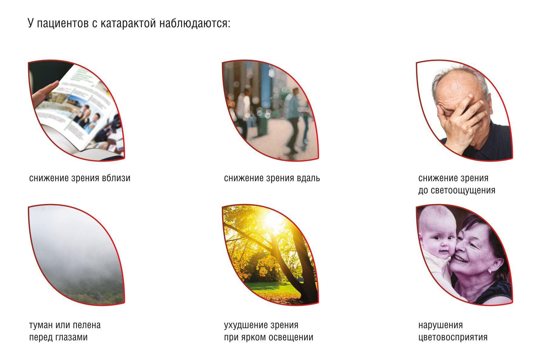 катаракта удаление, удаление катаракты, катаракта операция по удалению, операция по удалению катаракты, послеоперационная катаракта удаление катаракты послеоперационный, послеоперационный период после удаления катаракты, операция по удалению катаракты с заменой хрусталика,