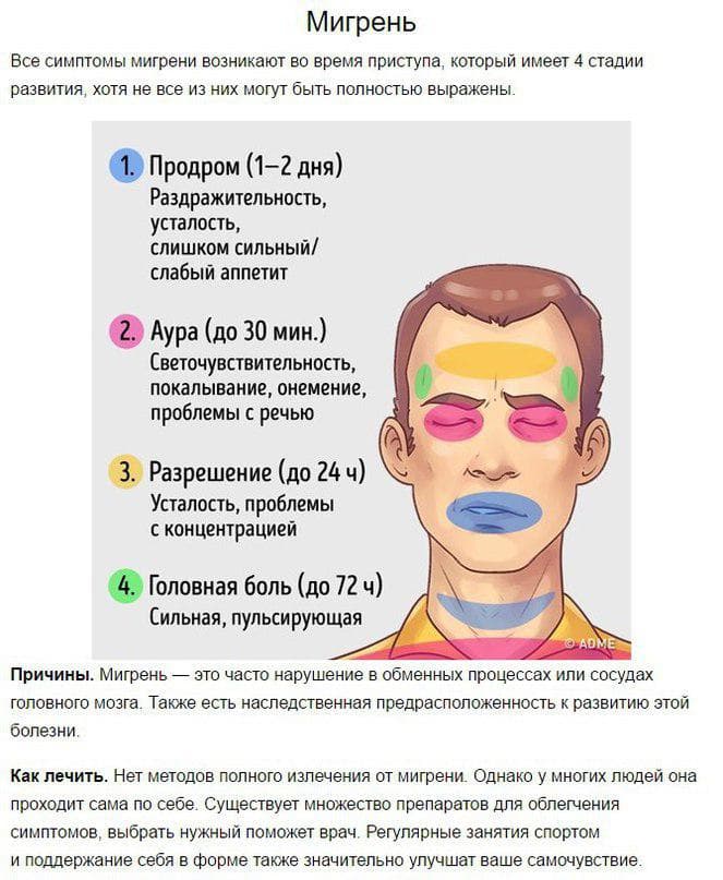 migren