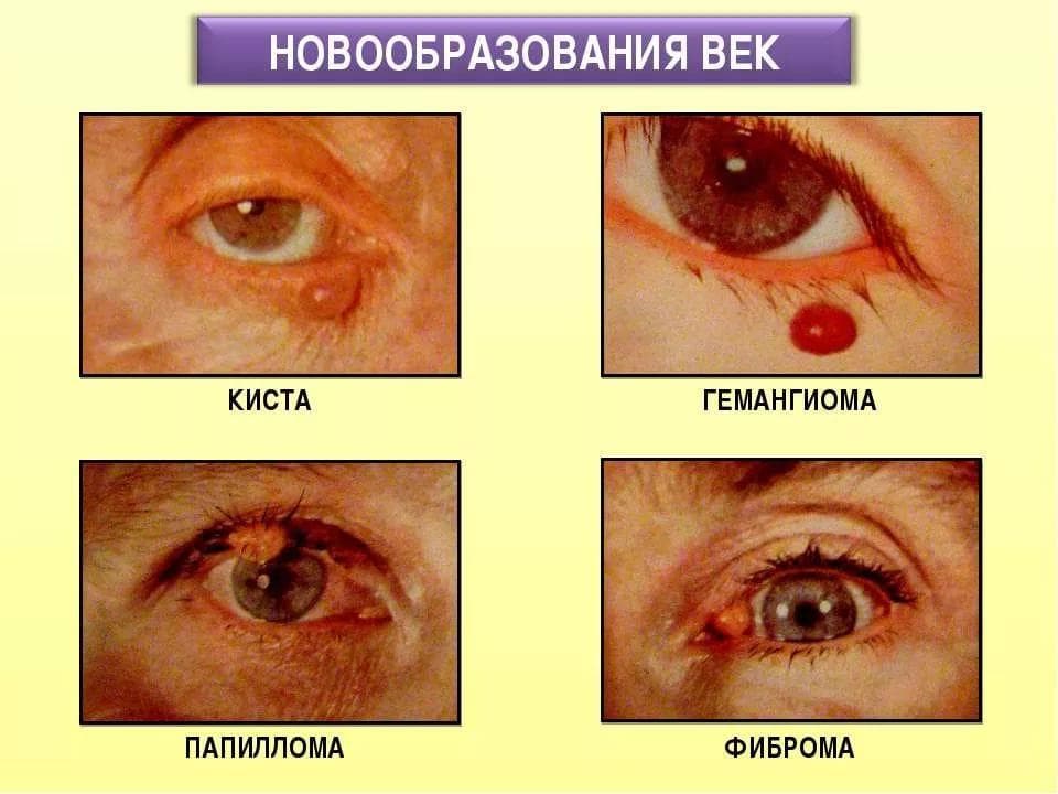 novoobrazovaniya-na-vekax