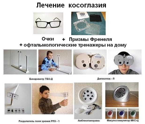 очки при косоглазии