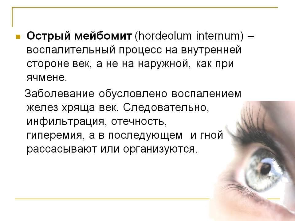 opredelenie-ostrogo-mejbomita