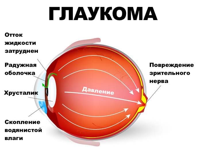 _
