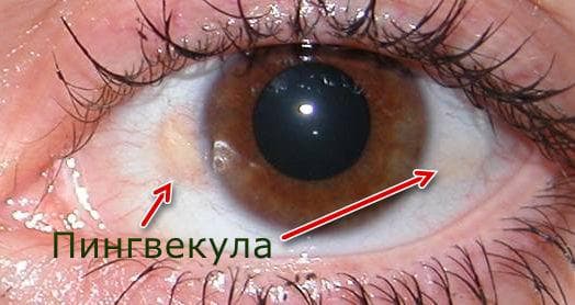 пингвекула глаза