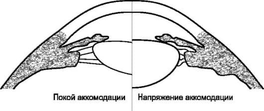 положение аккомодации