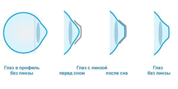 преимущества ОК-терапии