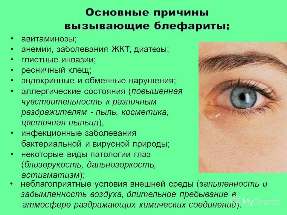 причины блефарита