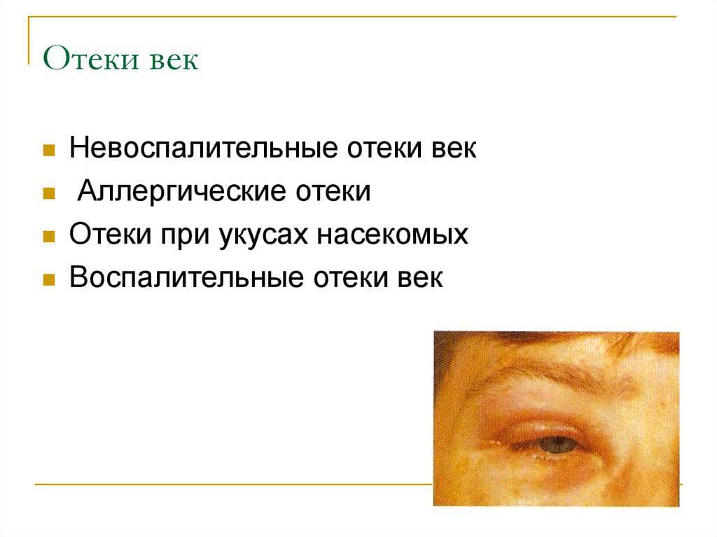 prichiny-otechnosti-vek
