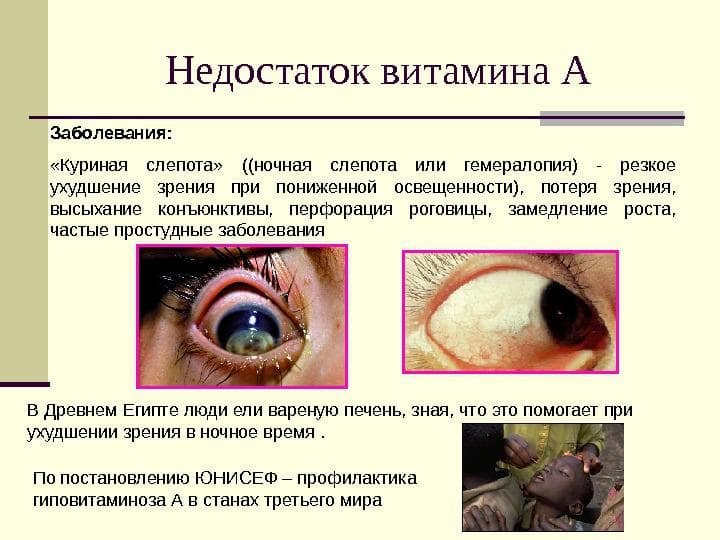 prichiny-vozniknoveniya-kurinoj-slepoty