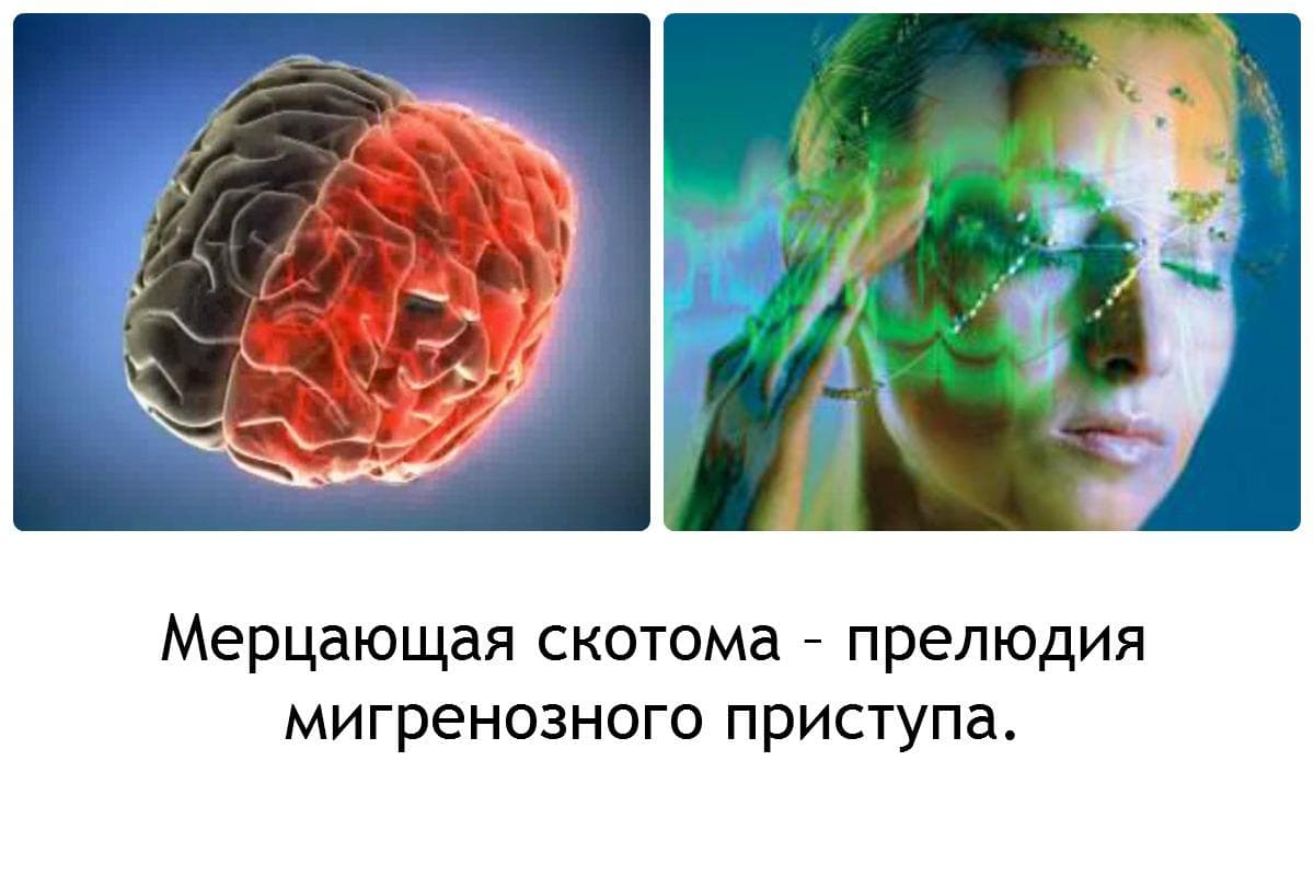 prichiny-vozniknoveniya-skotomy