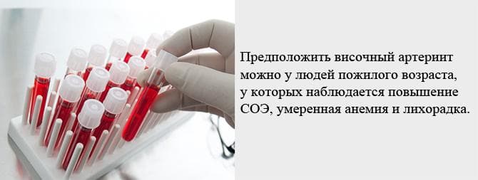 prichiny-vozniknoveniya-visochnogo-arteriita