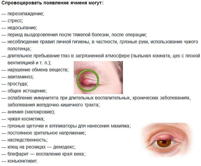 причины-вызывающие-ячмень-на-глазу