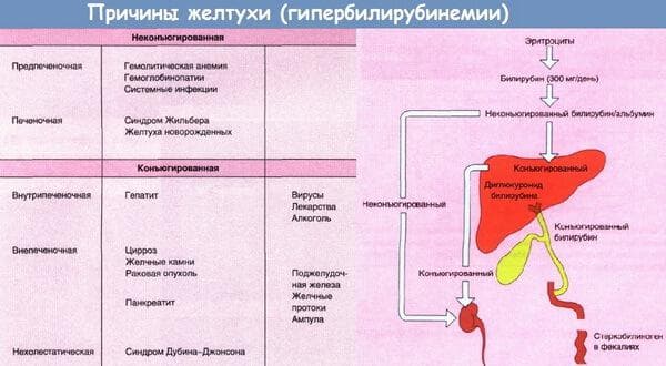 prichiny-zheltuxi
