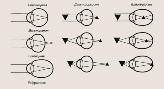 Проверка рефракции зрения