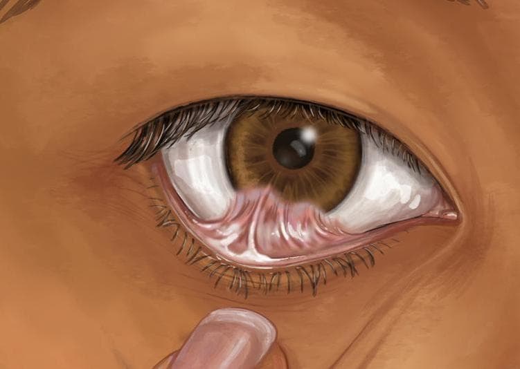 _