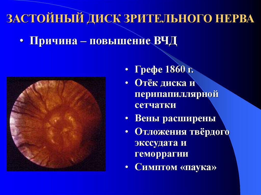 slide-29