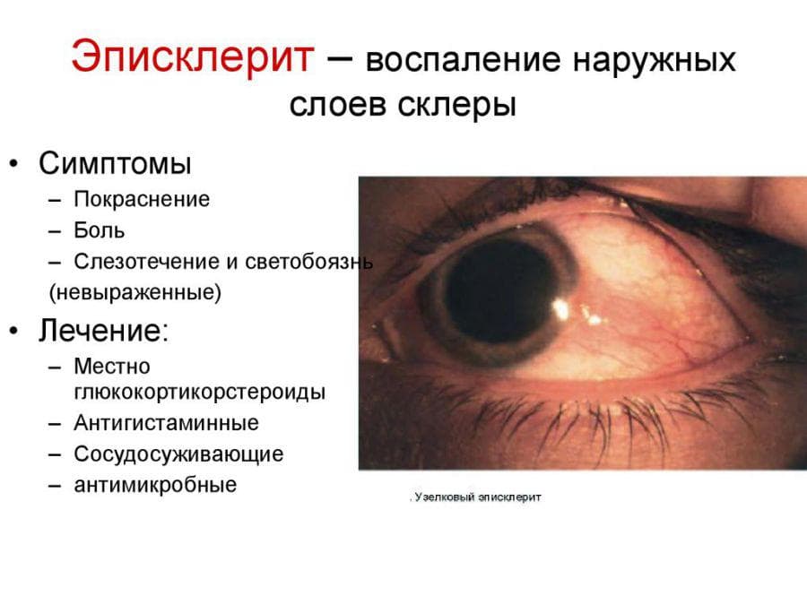 slide-32