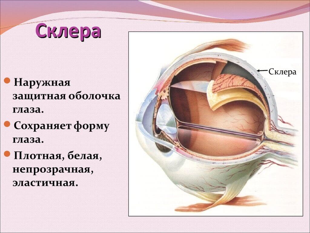 _