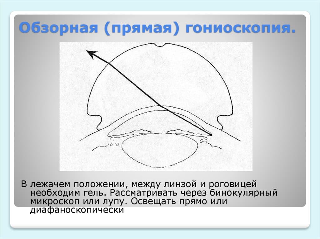 Гониоскопия
