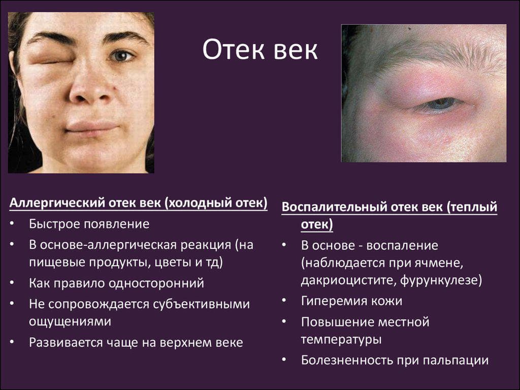 _