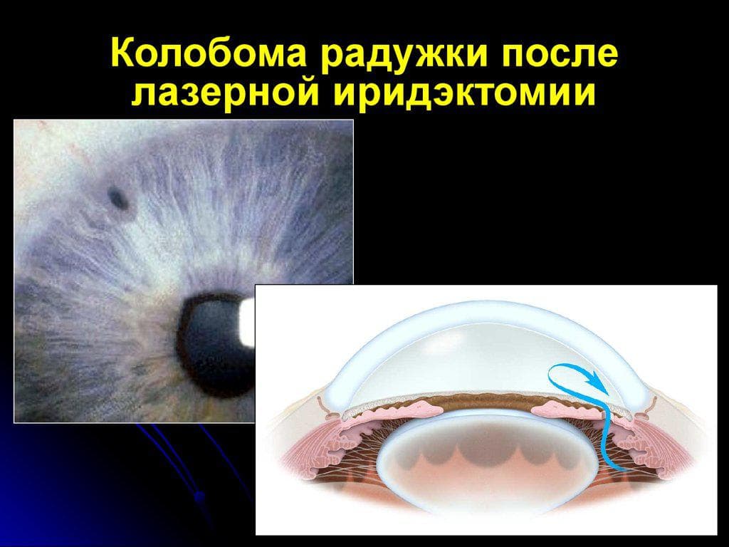 _