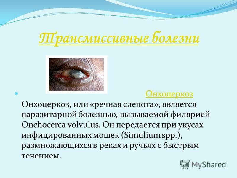 Онхоцеркоз