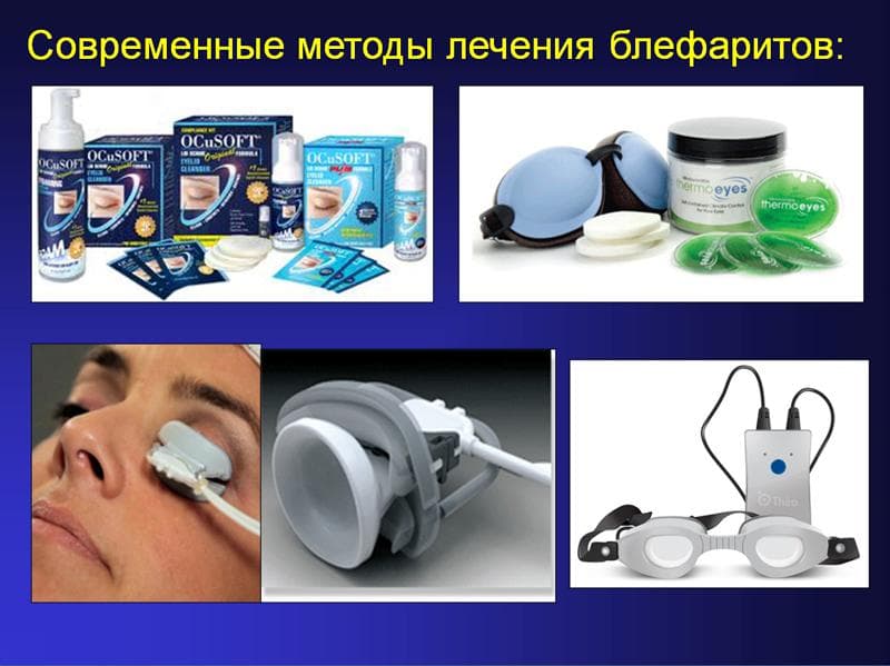 современные методы лечения блефаритов