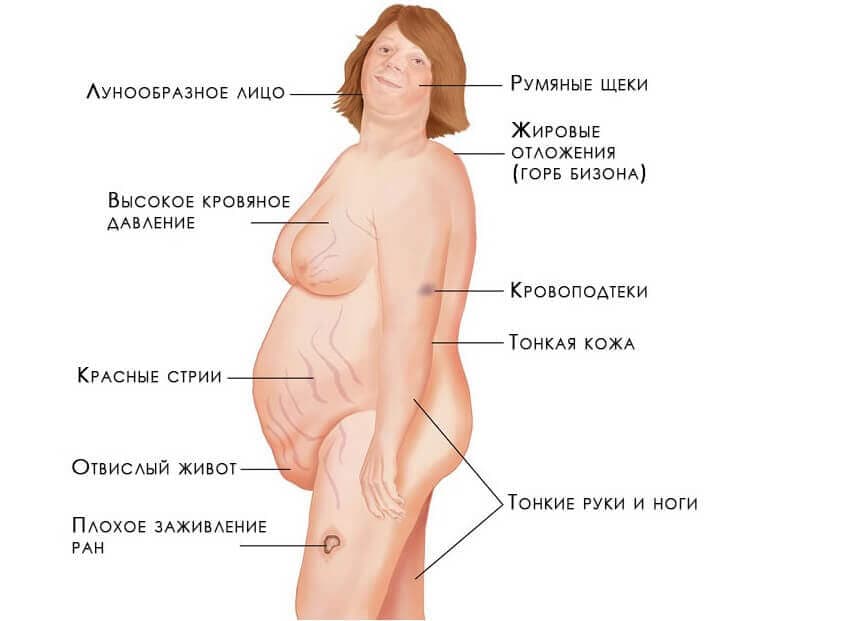 _