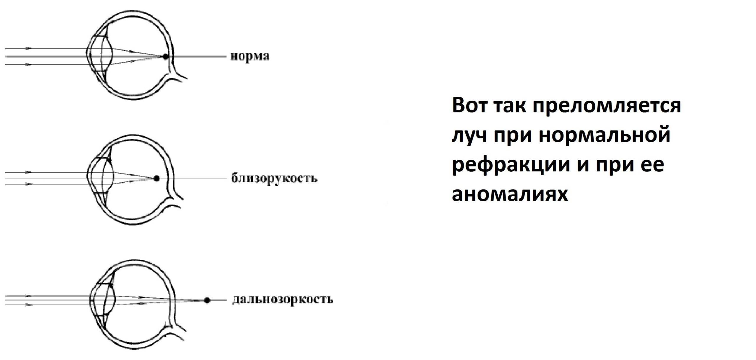 глазная таблица для проверки зрения, таблица офтальмолога для проверки зрения скачать, детская таблица для проверки зрения, таблица для проверки зрения у окулиста распечатать, проверка зрения онлайн по таблице сивцева, как называется таблица для проверки зрения, таблица рыбкина на дальтонизм, таблица головина для проверки зрения, таблица ситцева,