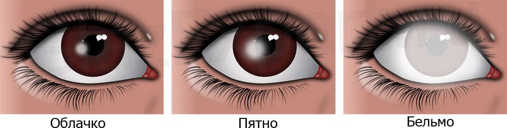 _