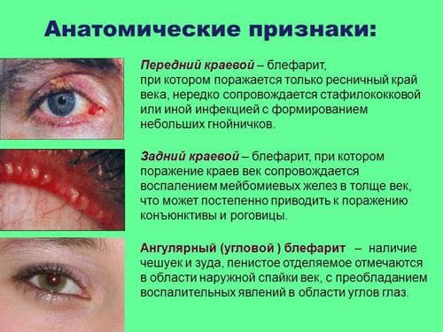 виды блефарита