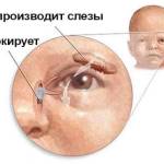 воспаление слезного мешка