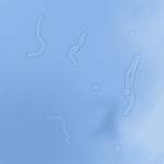 вспышки в глазах причины